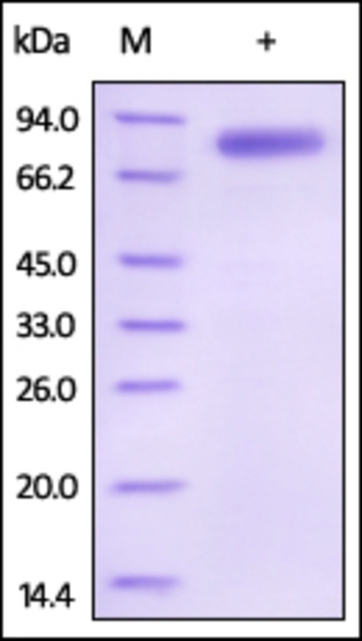 IL12 B Recombinant Protein