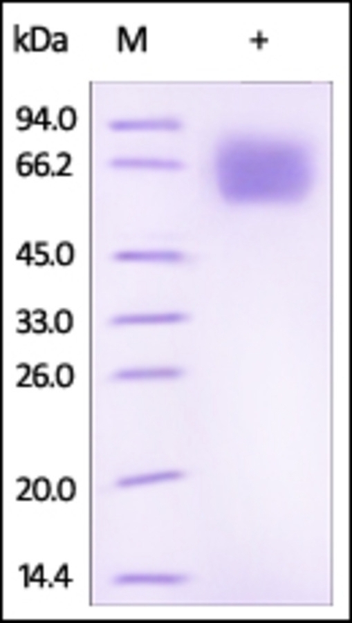 IL18 BP Recombinant Protein
