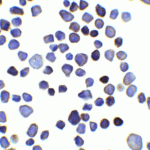 Immunocytochemistry of INPP4B in 3T3 cells with INPP4B antibody at 2.5 μg/ml.