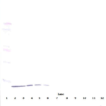 To detect Human IP-10 by Western Blot analysis this antibody can be used at a concentration of 0.25-0.50 ug/ml (non-reducing) or at a concentration of 1.0-2.0 ug/ml (reducing). When used in conjunction with compatible secondary reagents the detection limit for recombinant Human IP-10 is 0.20-0.40 ng/lane under non-reducing conditions and 2.00-4.00 ng/lane under reducing conditions.