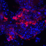Immunofluorescence of IQCF2 in human testis tissue with IQCF2 antibody at 20 μg/ml.<br><br>Red: IQCF2 Antibody (8419) <br> Blue: DAPI staining