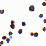 Immunocytochemistry of IQSEC1 in A-20 cells with IQSEC1 antibody at 2 μg/mL.
