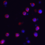 Immunofluorescence of IQSEC1 in A-20 cells with IQSEC1 antibody at 2 μg/mL.<br><br>Red: IQSEC1 Antibody (8009) <br> Blue: DAPI staining