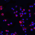 Immunofluorescence of IRAK-2 in Hela cells with IRAK 2 antibody at 20 μg/mL.<br><br>Red: IRAK2 Antibody (3595) <br> Blue: DAPI staining