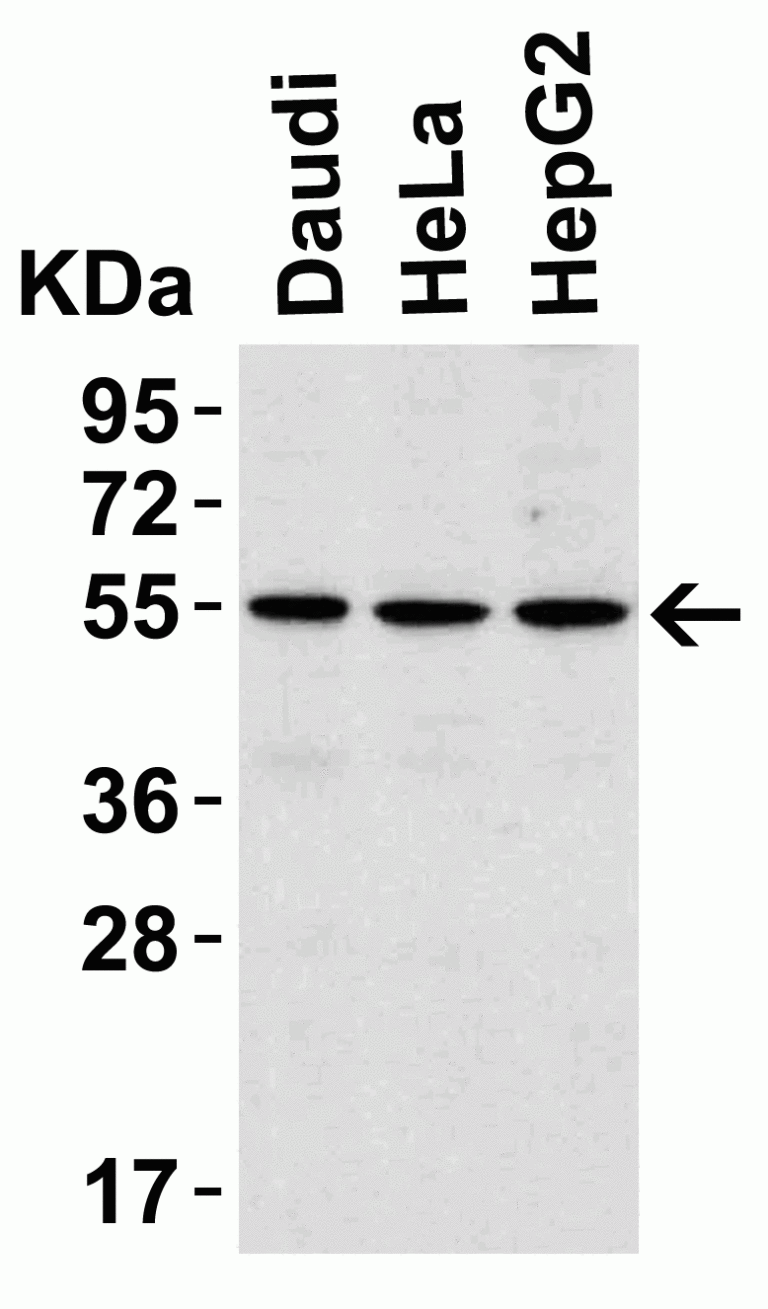 IRAK-4 Antibody