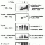 <strong>Figure 7 Immunoprecipitation and Overexpression Validation in HEK293T Cells(Schauvliege et al., 2006)</strong><br>Co-expression of Pellino proteins and IRAK-1 leads to Pellino phosphorylation and IRAK-1 polyubiquitination. (A) E-tagged Pellino proteins were co-expressed with IRAK-1WT and HA–ubiquitin in HEK293T cells. For assessment of IRAK-1 polyubiquitination, the same cellextracts, untreated or treated with phosphatase as described above, were analysed for slower migrating forms of IRAK-1 by Western blotting withanti-IRAK-1 (1007). Ubiquitination was specifically detected by IRAK-1 immunoprecipitation followed by Western blotting with anti-HA antibodies.