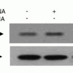 <strong>Figure 8 KD Validation in Human Chondrocytes (Ahmad et al., 2007)</strong><br>Chondrocytes were transfected with 250 nM of IRAK1 or control siRNA for 48 h and lysates were analyzed for IRAK1 or β-actin expression levels by immunoblotting. IRAK1 signal was disrupted in IRAK1 KD lysate.