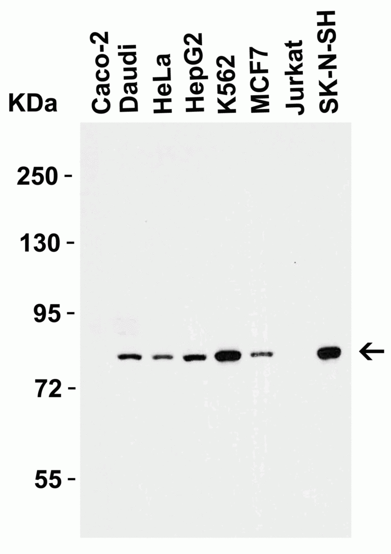 IRAK Antibody