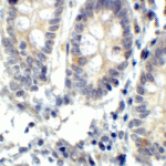 <strong>Figure 8 Immunohistochemistry Validation of IRE1p in Human Small Intestine Tissue </strong><br> Immunohistochemical analysis of paraffin-embedded Human Small Intestine Tissue using anti-IRE1P antibody (3655) at 2 μg/ml. Tissue was fixed with formaldehyde and blocked with 10% serum for 1 h at RT; antigen retrieval was by heat mediation with a citrate buffer (pH6). Samples were incubated with primary antibody overnight at 4°C. A goat anti-rabbit IgG H&L (HRP) at 1/250 was used as secondary. Counter stained with Hematoxylin.