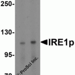 <strong>Figure 4 Western Blot Validation in Rat Brain Tissue Lysate</strong><br>Loading: 15 μg of lysates per lane.Antibodies: IRE1p 3655 (A: 0.5 μg/mL, B: 1 μg/mL), 1h incubation at RT in 5% NFDM/TBST.Secondary: Goat anti-rabbit IgG HRP conjugate at 1:10000 dilution.