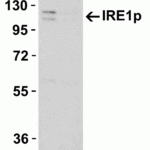 <strong>Figure 2 KO Validation in HeLa Cells</strong><br>Loading: 10 μg of WT cell lysates (lane 1) or IRE1P KO cell lysates (lane 2).Antibodies: IRE1P 3655 (0.5 μg/mL) and beta-actin (1 μg/mL), 1h incubation at RT in 5% NFDM/TBST.Secondary: Goat anti-rabbit IgG HRP conjugate at 1:10000 dilution.