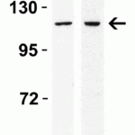 <strong>Figure 3 Western Blot Validation in Human Cell Lines</strong><br>Loading: 15 μg of lysates per lane.Antibodies: IRE1p 3655 (0.4 μg/mL), 1h incubation at RT in 5% NFDM/TBST.Secondary: Goat anti-rabbit IgG HRP conjugate at 1:10000 dilution.Lane 1: Caco-2, Lane2: SK-N-SH
