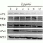 <strong>Figure 11 Induced Expression Validation of IRE1p in human umbilical vein endothelial cells (HUVECs) (Wang et al., 2019) </strong><br>IRE1p expression was examined by Western blot analysis with anti-IRE1p antibodies (3655). IRE1p was increased in HUVEC cells treated with 10 μM 20(S)PPD for 6 to 8 hours compared with control cells.