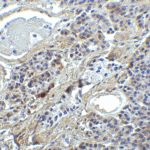 <strong>Figure 8 Immunohistochemistry Validation of IRF7 in Human Pancreas Tissue</strong><br> Immunohistochemical analysis of paraffin-embedded human pancreas tissue using anti-IRF7 antibody (8991) at 2 μg/ml. Tissue was fixed with formaldehyde and blocked with 10% serum for 1 h at RT; antigen retrieval was by heat mediation with a citrate buffer (pH6). Samples were incubated with primary antibody overnight at 4°C. A goat anti-rabbit IgG H&L (HRP) at 1/250 was used as secondary. Counter stained with Hematoxylin.