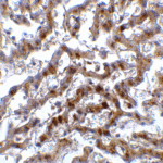 <strong>Figure 9 Immunohistochemistry Validation of IRF7 in Human Liver Tissue</strong><br> Immunohistochemical analysis of paraffin-embedded human liver tissue using anti-IRF7 antibody (8991) at 2 μg/ml. Tissue was fixed with formaldehyde and blocked with 10% serum for 1 h at RT; antigen retrieval was by heat mediation with a citrate buffer (pH6). Samples were incubated with primary antibody overnight at 4°C. A goat anti-rabbit IgG H&L (HRP) at 1/250 was used as secondary. Counter stained with Hematoxylin.
