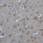 <strong>Figure 11 Immunohistochemistry Validation of IRF7 in Rat Brain Tissue</strong><br> Immunohistochemical analysis of paraffin-embedded rat brain tissue using anti-IRF7 antibody (8991) at 5 μg/ml. Tissue was fixed with formaldehyde and blocked with 10% serum for 1 h at RT; antigen retrieval was by heat mediation with a citrate buffer (pH6). Samples were incubated with primary antibody overnight at 4 °C. A goat anti-rabbit IgG H&L (HRP) at 1/250 was used as secondary. Counter stained with Hematoxylin.