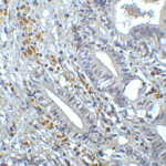 <strong>Figure 7 Immunohistochemistry Validation of IRF7 in Human Colon Tissue</strong><br> Immunohistochemical analysis of paraffin-embedded human colon tissue using anti-IRF7 antibody (8991) at 2 μg/ml. Tissue was fixed with formaldehyde and blocked with 10% serum for 1 h at RT; antigen retrieval was by heat mediation with a citrate buffer (pH6). Samples were incubated with primary antibody overnight at 4°C. A goat anti-rabbit IgG H&L (HRP) at 1/250 was used as secondary. Counter stained with Hematoxylin.