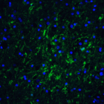 Immunofluorescence of IRGM in Human Brain tissue with IRGM antibody at 20 μg/mL.<br><br>Green: IRGM Antibody (4543) <br> Blue: DAPI staining