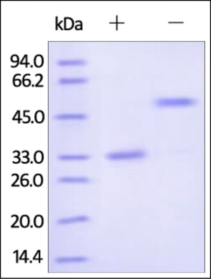 IgG2 Fc Region Recombinant Protein