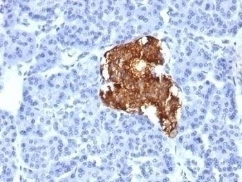 Insulin Antibody [IRDN/805]