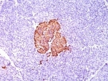 Insulin Antibody [SPM139]