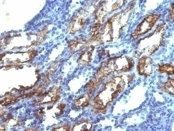 Interferon gamma Antibody [IFNG/466]