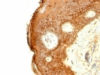Involucrin Antibody [SPM259]