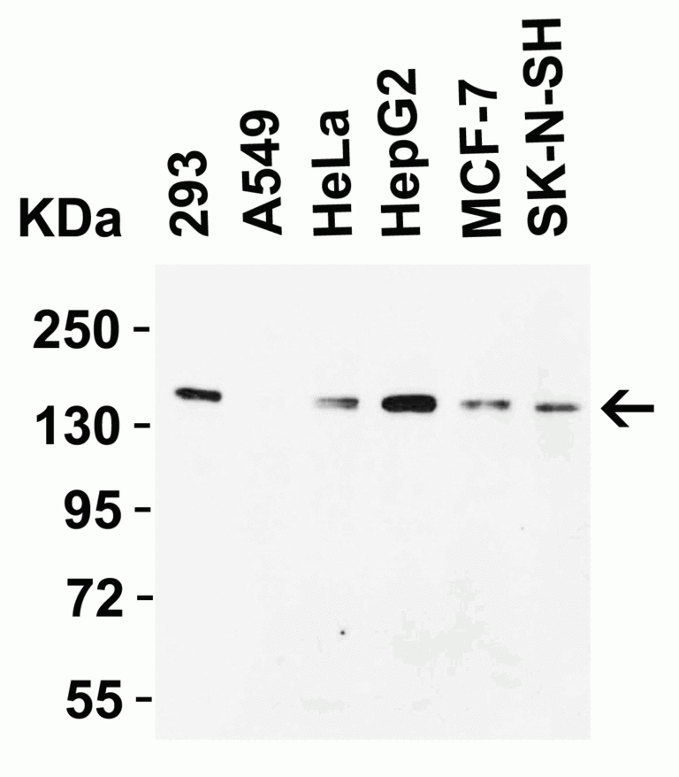 JMJD1A Antibody