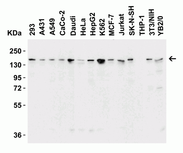 JMJD3 Antibody