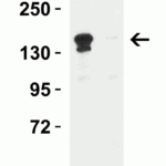 <strong>Figure 5 Western Blot Validation in Mouse A-20 Cell Lysate </strong><br>Loading: 15 μg of lysates per lane.Antibodies: : JMJD3, 6657 (0.5 μg/mL) , 1h incubation at RT  in 5% NFDM/TBST.Secondary: Goat anti-rabbit IgG HRP conjugate at 1:10000 dilution.Lane 1: in the absence  and Lane 2: in the presence of  blocking peptide