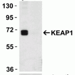 <strong>Figure 3 KO Validation in HeLa cells</strong><br> Loading: 10 μg of HeLa WT cell lysates or KEAP1 KO cell lysates. Antibodies:  KEAP1 7045 (2 μg/mL) and beta-actin 3779 (1 μg/mL), 1 h incubation at RT in 5% NFDM/TBST.Secondary: Goat Anti-Rabbit IgG HRP conjugate at 1:10000 dilution.