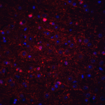 Immunofluorescence of KIF5 in mouse brain tissue with KIF5 antibody at 20 μg/mL.<br><br>Red: KIF5 Antibody (4289) <br> Blue: DAPI staining