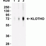 <strong>Figure 2 Western Blot Validation with Recombinant Protein</strong><br>Loading: 30 ng of human KLOTHO recombinant protein per lane.Antibodies: KLOTHO 6107 (Lane 1: 1 μg/mL, Lane 2: 2 μg/mL and Lane 3: 4 μg/mL), 1h incubation at RT  in 5% NFDM/TBST.Secondary: Goat anti-rabbit IgG HRP conjugate at 1:10000 dilution.Observed at around 72kD.