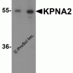 Western blot analysis of KPNA2 expression in Daudi cell lysate with KPNA2 antibody at (A) 1 and (B) 2 μg/ml.