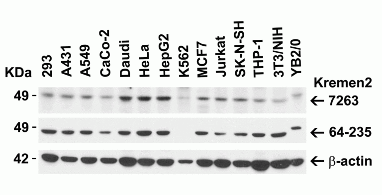 KREMEN2 Antibody