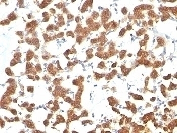 Keratin 18 Antibody [C-04 or Ks18.04]