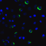 Immunofluorescence of LAG-3 in transfected HEK293 cells with LAG-3 single domain antibody at 5 μg/mL.