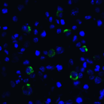 Immunofluorescence of LAG-3 in transfected HEK293 cells with LAG-3 single domain antibody at 5 μg/mL.