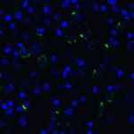 Immunofluorescence of LAG-3 in transfected HEK293 cells with LAG-3 single domain antibody at 5 μg/mL.