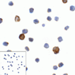 Immunocytochemistry of LAG-3 in over expressing HEK293 cells using LAG-3 antibody and control mouse IgG antibody (left corner box) at 1 μg/ml.