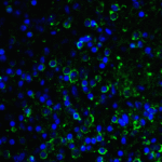 Immunofluorescence of LAG-3 in over human spleen tissue using LAG-3 Antibody at 10 μg/ml.<br><br>Green: LAG3 Antibody [1G4] (RF16089) <br> Blue: DAPI staining