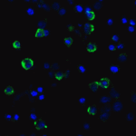 Immunofluorescence of LAG-3 in transfected HEK293 cells with LAG-3 single domain antibody at 5 μg/mL.