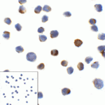 Immunocytochemistry of LAG-3 in over expressing HEK293 cells using LAG-3 antibody and control mouse IgG antibody (left corner box) at 1 μg/ml.