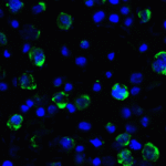 Immunofluorescence of LAG-3 in over expressing HEK293 cells using LAG-3 Antibody at 2 μg/ml.<br><br>Green: LAG3 Antibody [2G8] (RF16082) <br> Blue: DAPI staining