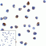 Immunocytochemistry of LAG-3 in over expressing HEK293 cells using LAG-3 antibody and control mouse IgG antibody (left corner box) at 1 μg/ml.