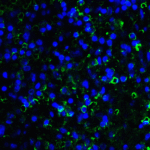 Immunofluorescence of LAG-3 in over human spleen tissue using LAG-3 Antibody at 10 μg/ml.<br><br>Green: LAG3 Antibody [5F11] (RF16088) <br> Blue: DAPI staining