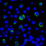 Immunofluorescence of LAG-3 in over expressing HEK293 cells using LAG-3 Antibody at 2 μg/ml.<br><br>Green: LAG3 Antibody [5F11] (RF16088) <br> Blue: DAPI staining
