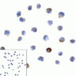 Immunocytochemistry of LAG-3 in over expressing HEK293 cells using LAG-3 antibody and control mouse IgG antibody (left corner box) at 1 μg/ml.