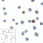 Immunocytochemistry of LAG-3 in over expressing HEK293 cells using LAG-3 antibody and control mouse IgG antibody (left corner box) at 1 μg/ml.