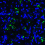 Immunofluorescence of LAG-3 in over human spleen tissue using LAG-3 Antibody at 10 μg/ml.<br><br>Green: LAG3 Antibody [6D1] (RF16087) <br> Blue: DAPI staining